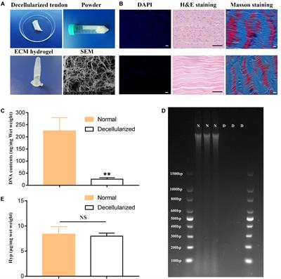 Desktop-Stereolithography 3D Printing of a Polyporous Extracellular Matrix Bioink for Bone Defect Regeneration